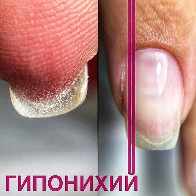Как называется кожа под ногтем которая отрастает
