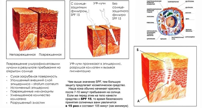 Воздействие УФ лучей на кожу. Влияние ультрафиолета на кожу. Ультрафиолетовые лучи на коже. Слой кожи защищающий от УФ лучей. Радиация кожи