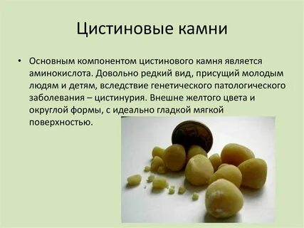 Потов и медамвитоминовый камень