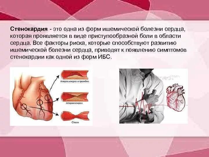 Содержание сердечный