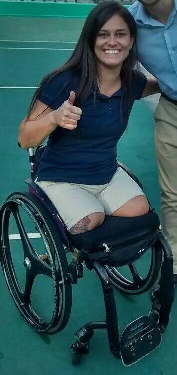 Инвалиды уроды. Ампути 2022. Девушка инвалид. Инвалид без ног на коляске.