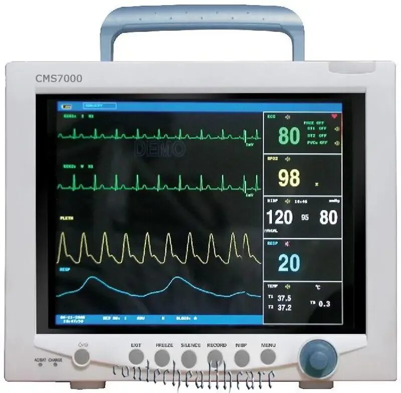 Монитор анестезии. Монитор Мульти - параметровый пациента Star 8000а. Монитор пациента в40 электроды для ЭКГ. Кардиомонитор gt 6800 vet. Монитор пациента Vista 120 c принадлежностями.