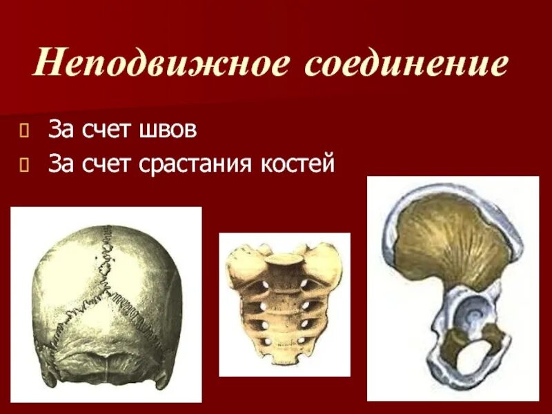 Неподвижное соединение. Неподвижные кости. Неподвижное соединение костей с помощью швов. Подвижные и неподвижные кости.