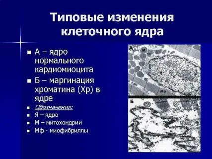 Конденсация хроматина