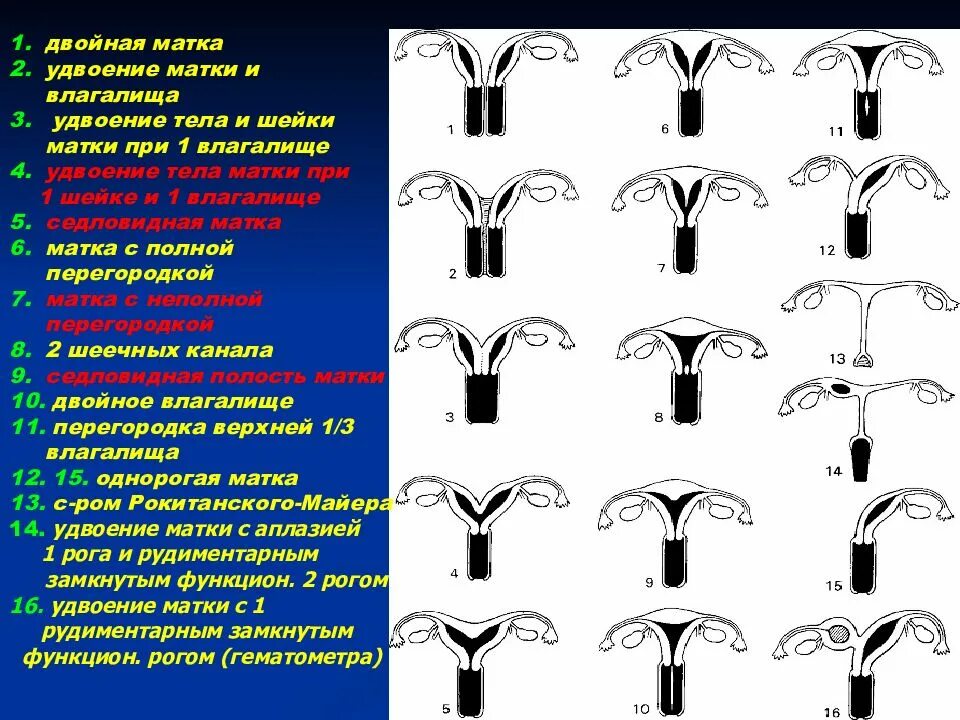 Аномалии развития положения век. Пороки развития половых органов. Аномалии развития матки классификация. Пороки развития влагалища и матки презентация.