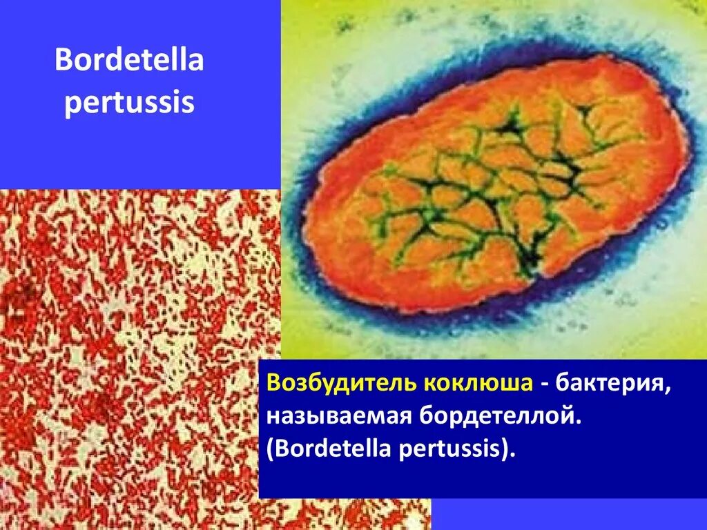 Возбудитель коклюша Bordetella pertussis. Адгезины Bordetella pertussis. Таксономия бордетелла пертуссис. Bordetella pertussis коклюш. Anti bordetella pertussis положительный