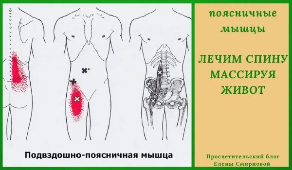 Квадратная мышца поясницы триггерные точки. Триггерные точки подвздошно поясничная. Подвздошно поясничная мышца триггеры. Подвздошная мышца триггерные точки. Поясницы отдающая в пах