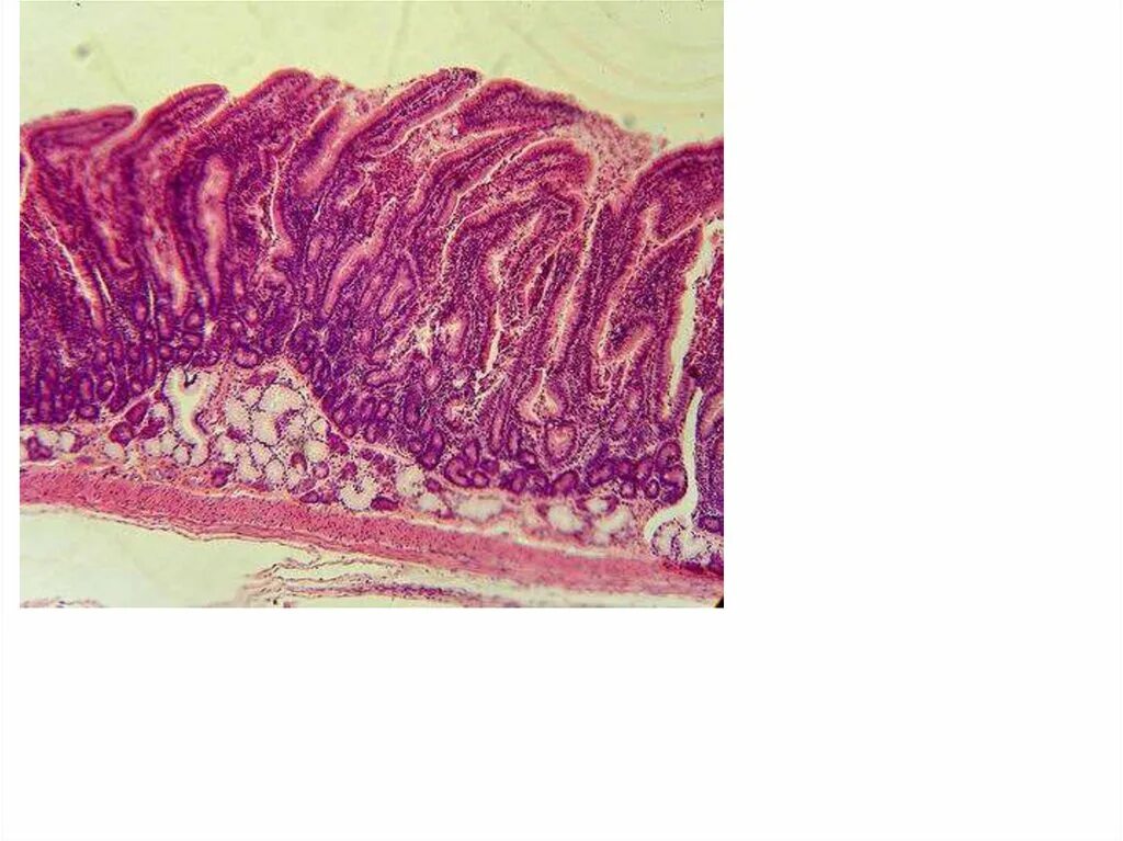 Слизистая оболочка 12 кишки. 12 Перстная кишка гистология. Слизистая 12 перстной кишки гистология. Стенка 12 перстной кишки гистология. Эпителий Толстого кишечника гистология.