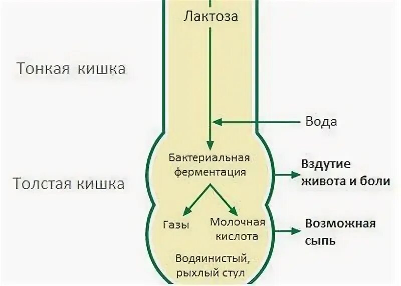 Как выявить непереносимость лактозы. Непереносимость лактозы. лактозная непереносимость. непереносимость лактозы симптомы. непереносимость лактозы препараты.