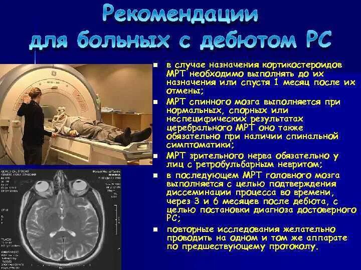 Демиелинизирующие заболевания нервной системы мрт. Демиелинизирующее заболевание мрт. Демиелинизирующее заболевание головного мозга мрт. Демиелинизирующий процесс головного мозга на мрт. Признаки демиелинизирующего поражения