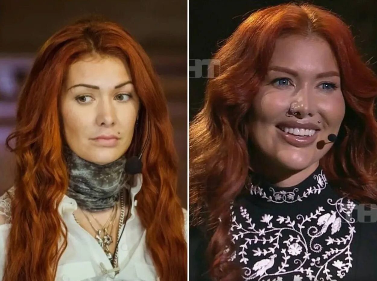 Николь кузнецова до и после пластики Николь Кузнецова снова может дышать самостоятельно Обо всем в мире Дзен
