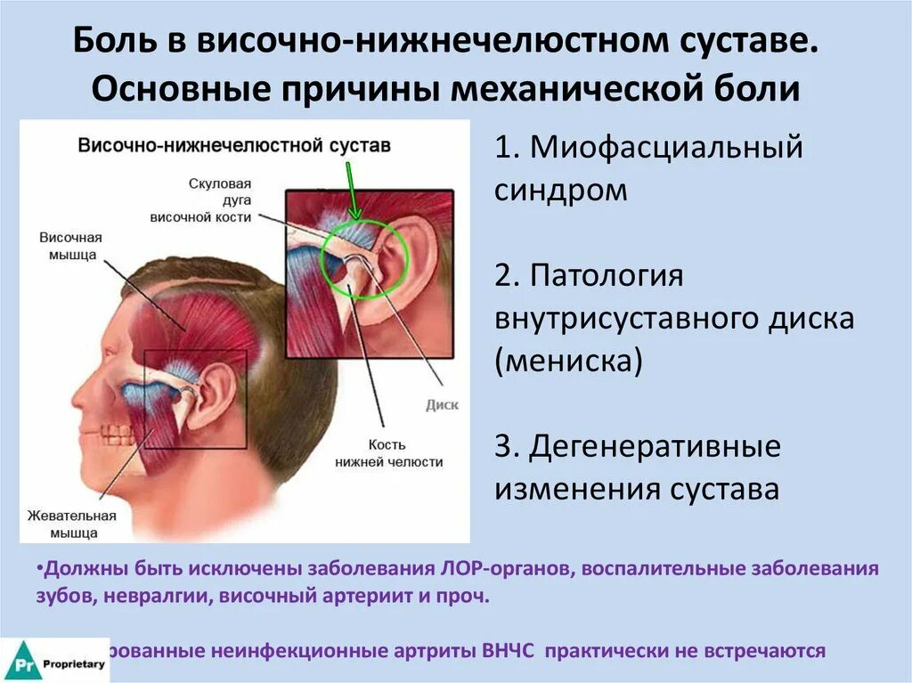 Внчс уха. Дисфункция ВНЧС симптомы. Синдром дисфункции ВНЧС. Синдром дисфункции височно-нижнечелюстного сустава. Воспаление височно челюстного сустава.