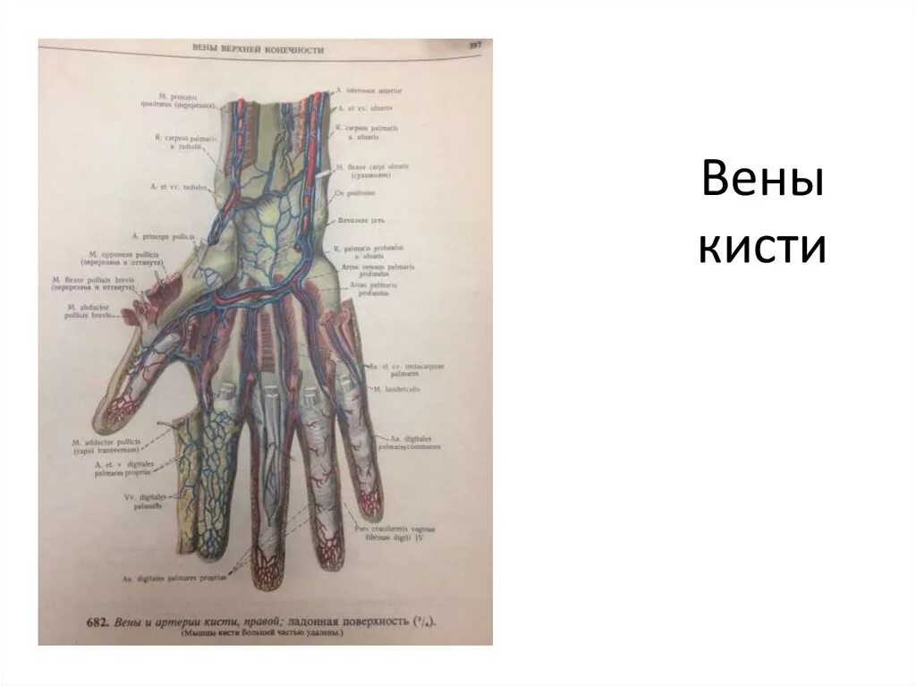 Поверхностные вены кисти, предплечья (тыльная поверхность). Вена кисти. Вена кисти. Ладонные артериальные дуги. Венозная сеть тыла кисти.