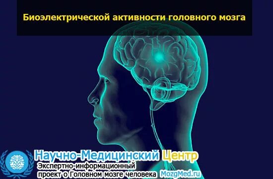 Диффузная дезорганизация биоэлектрической активности мозга. Биоэлектрическая активность мозга. БЭА головного мозга. Биоэлектрическая активность мозга детей. Биоэлектрическая активность головного мозга исследования.