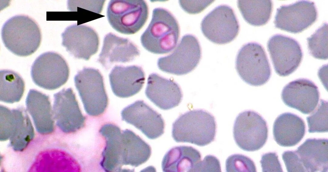 Пироплазмоз после лечения. Babesia canis под микроскопом.