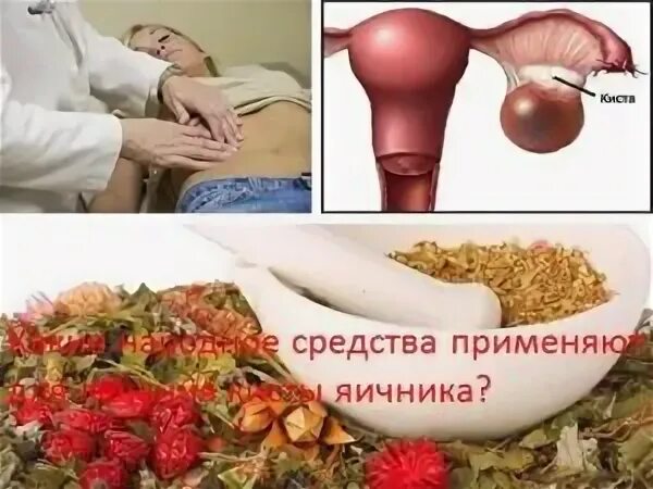 Кольпит (вагинит) - симптомы, цены на лечение кольпита в Москве Сеть медицинских