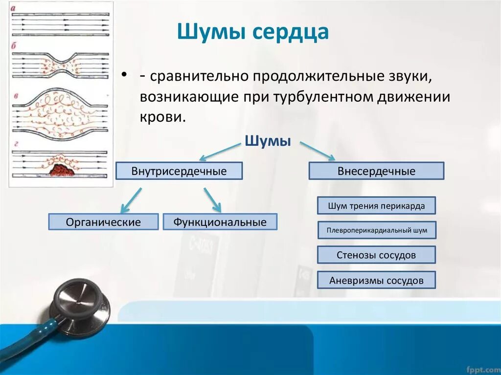 Причины появления шумов. Морфологические причины образования шумов сердца. Функциональные шумы сердца причины. Классификация органических шумов сердца. Патологические шумы сердца.