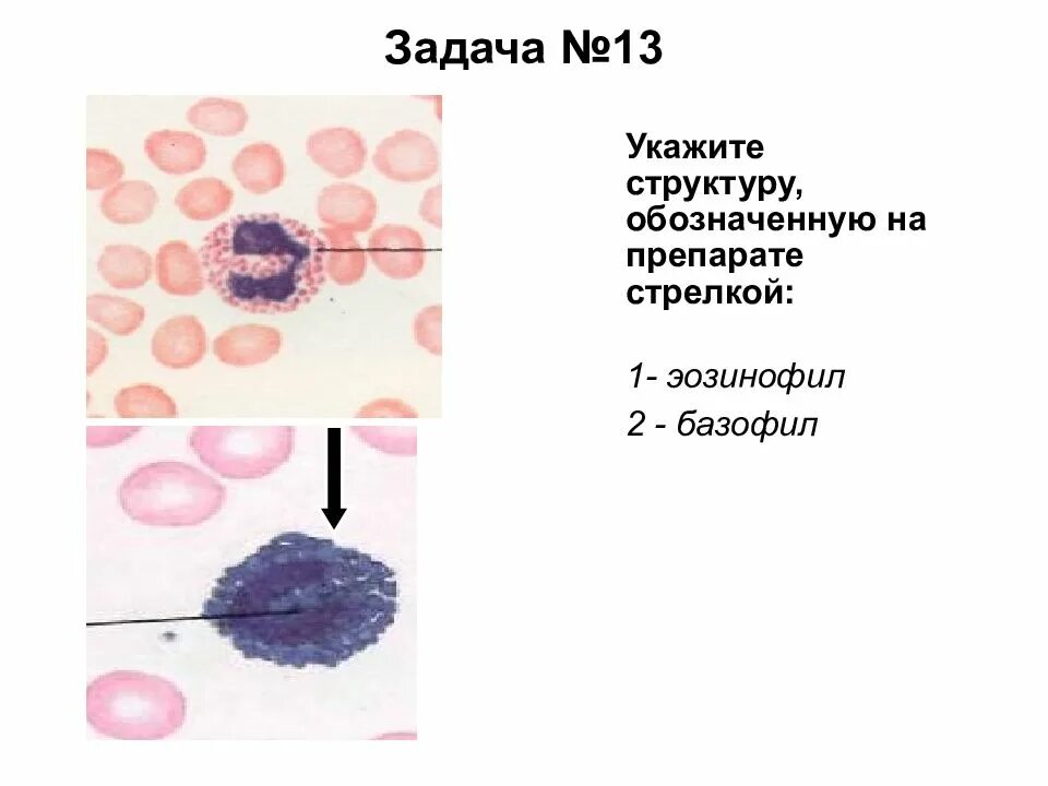 Базофилы гистология строение. Базофил под микроскопом. Строение базофилов крови. Эозинофилы гистология препарат. Эозинофилы 2 базофилы 2
