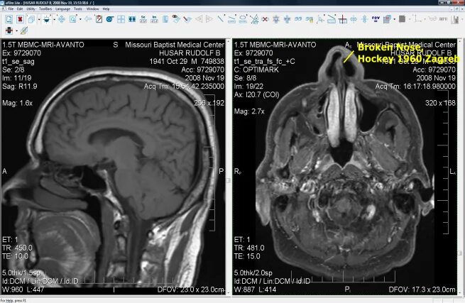 Как открыть мрт. Снимки в формате dicom мрт. снимки в формате dicom кт. диск мрт. диск для компьютерной томографии.