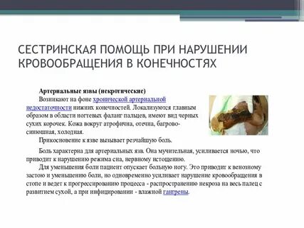 Медицинская помощь при остром нарушении кровообращения