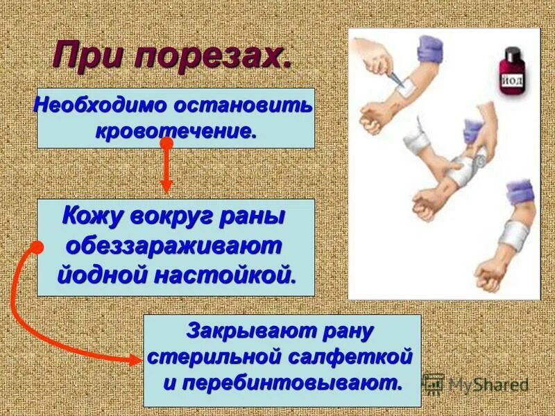 Первая помощь при порезе стеклом