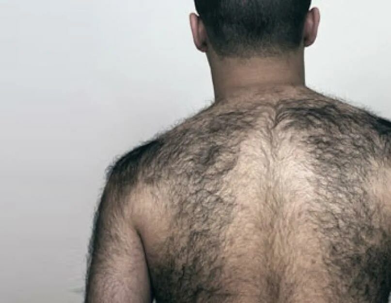 Причина волос на теле. Волосатая спина у мужчин. Мужская спина небритая.