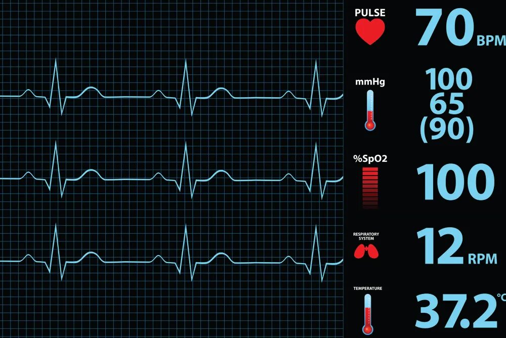 Операция пульсе. Измерение кровяного давления. Аппарат показывающий пульс. Операция пульсе. Операция пульсе.