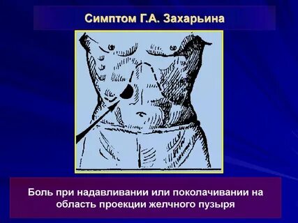 Симптом кера