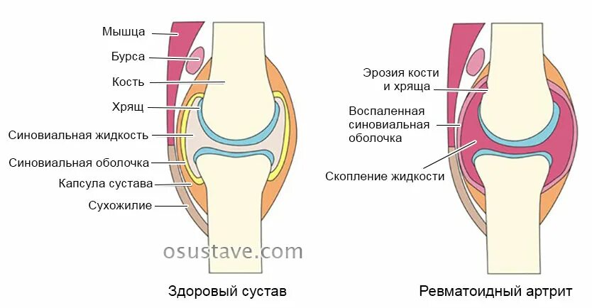 Синовиальная жидкость 2. Синовиальная жидкость 2