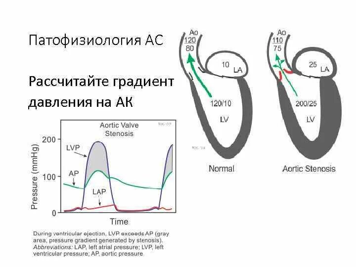 Градиент давления норма. Градиент давления норма