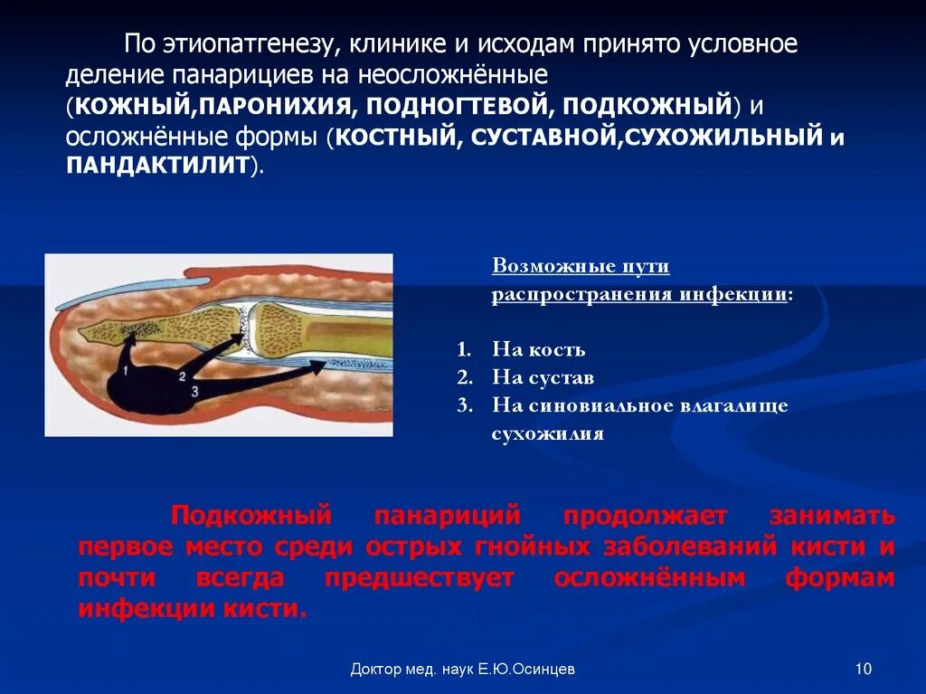 Отток экссудата