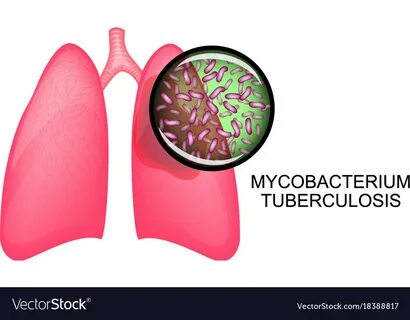 Микобактерия туберкулеза лечение