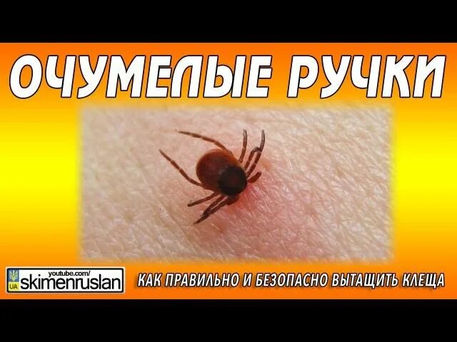 Клещ удалить в домашних