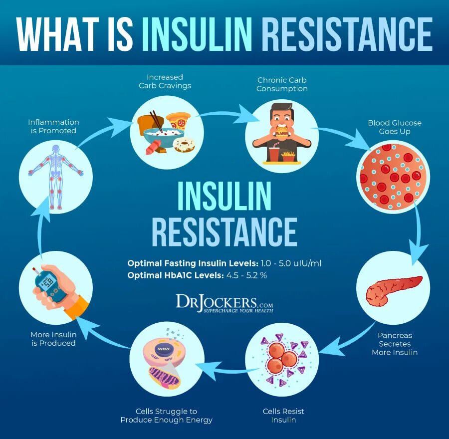 Инфламэйджинг. Insulin Resistance. Insulin Resistance Symptoms. Insulin Resistance Diet. Фаст инсулин