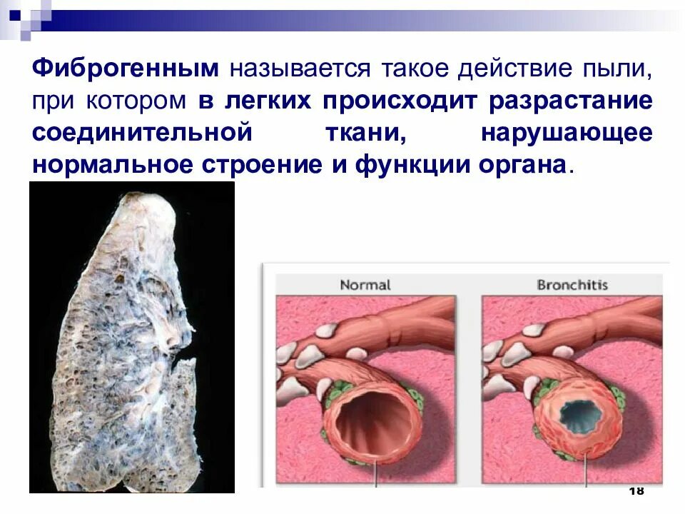 Фиброгенность по отношению к аэрозолям чем является