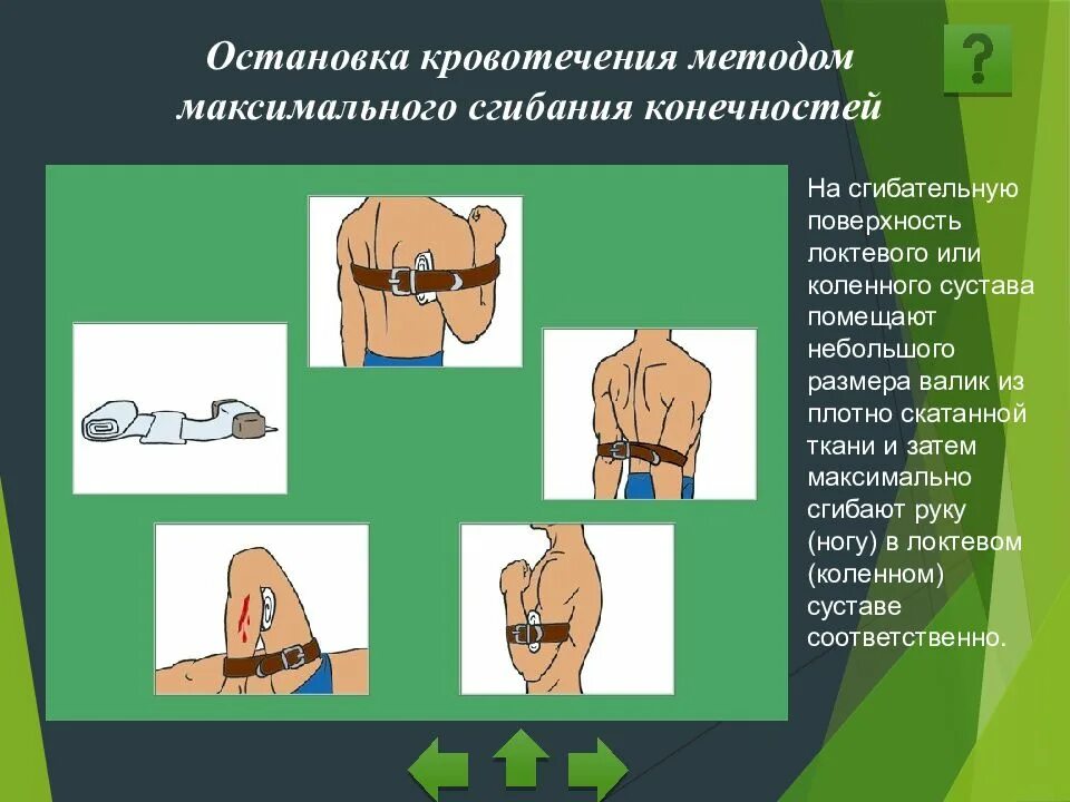 Остановка кровотечения путем сгибания конечности. Способы остановки кровотечения максимальное сгибание конечности. Сгибание конечности в суставе. Максимальное сгибание конечности при кровотечении. Остановка кровотечения методом сгибания конечностей.