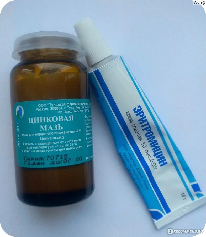 Цинк от прыщей на лице. Синтомицино цинковая мазь. мазь от прыщей. мазь от акне. мазь от угрей и прыщей на лице.