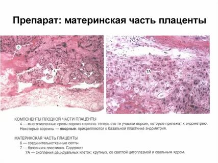 Материнская плацента
