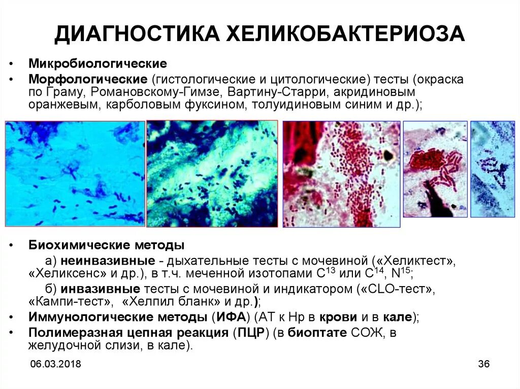 Цитологические и гистологические исследования. Метод диагностики Helicobacter pylori:. Методы выявления бактерии Helicobacter pylori. Гистологический метод диагностики хеликобактер. Гистологический метод диагностики Helicobacter pylori.