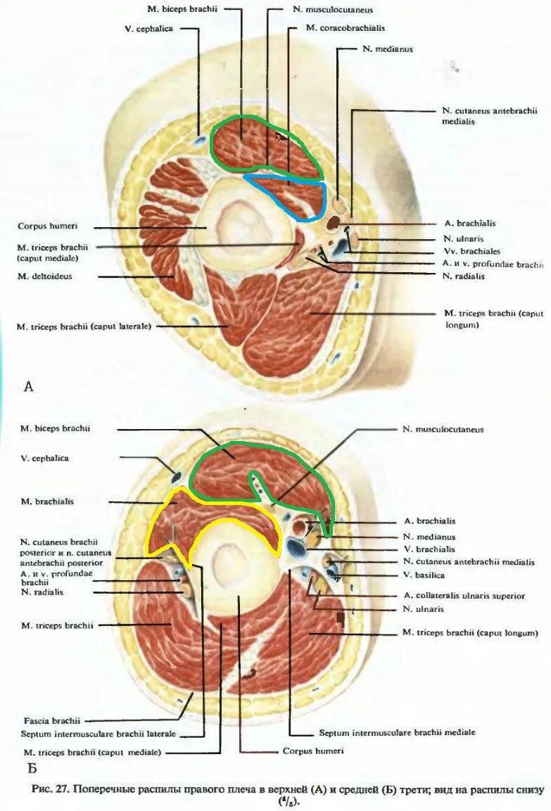 Топографические срезы. Поперечные срезы топографическая анатомия. Поперечный срез плеча верхняя треть. Поперечные срезы плеча топографическая анатомия. Верхный треть плеча топографическая анатомия.