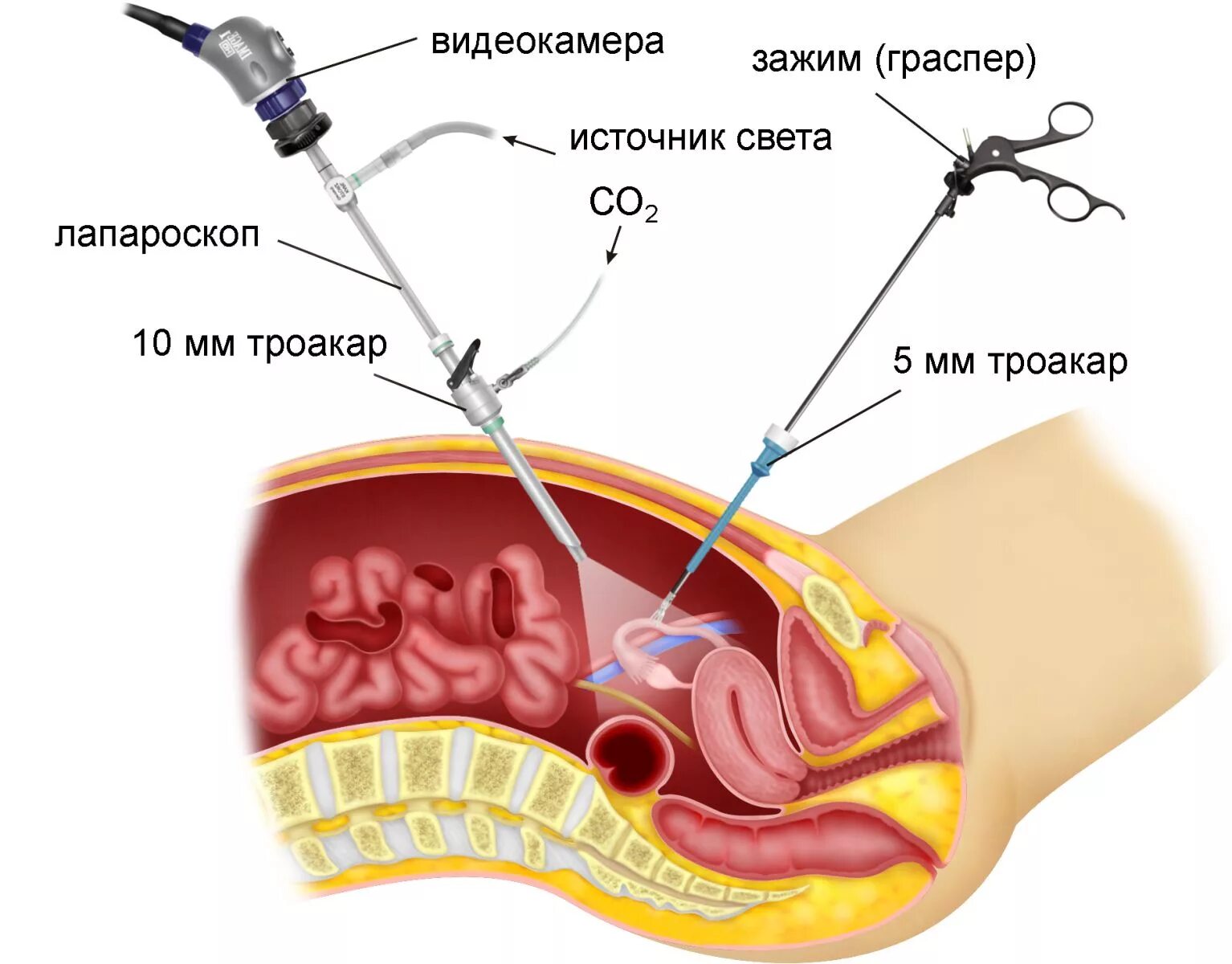 После удаления матки гинеколог