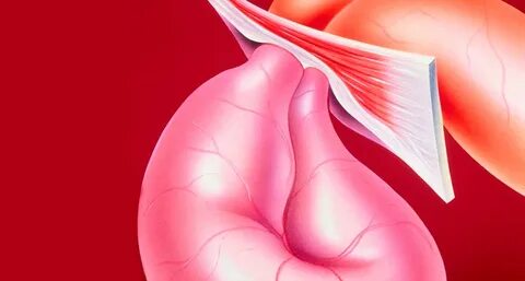 Ущемление грыжевого мешка: найдено 71 картинок