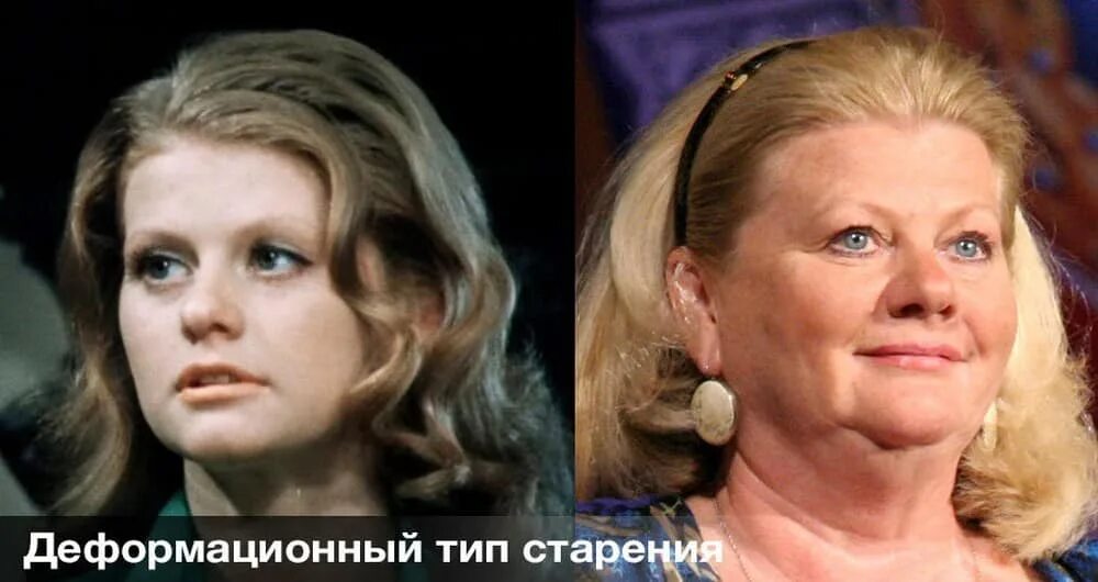 Деформационно отечный тип старения. Деформационно отечный тип старения. Ирина муравьева деформационный тип старения. Типы старения лица. Деформационно отечный тип старения.