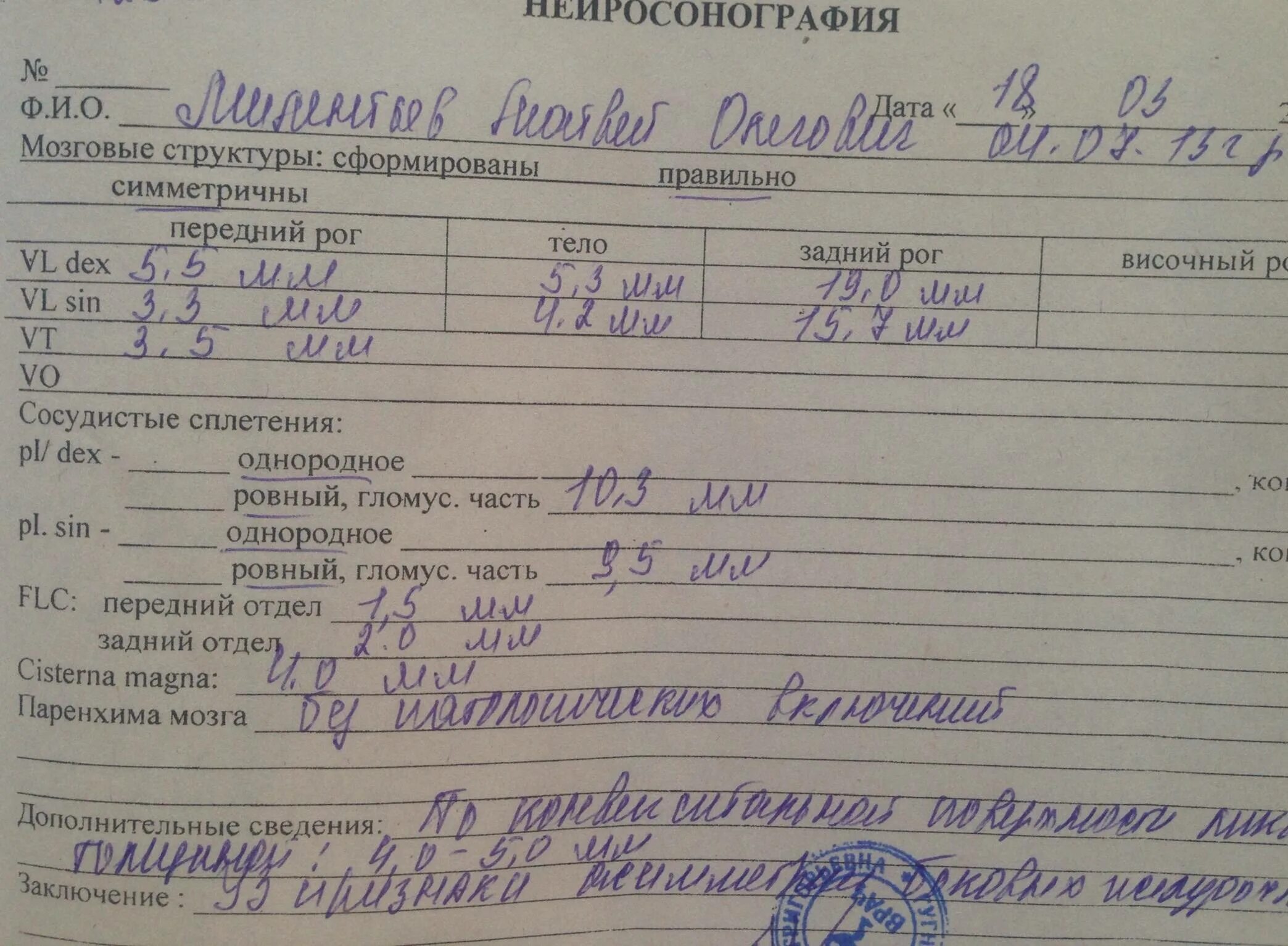 Мпщ сап