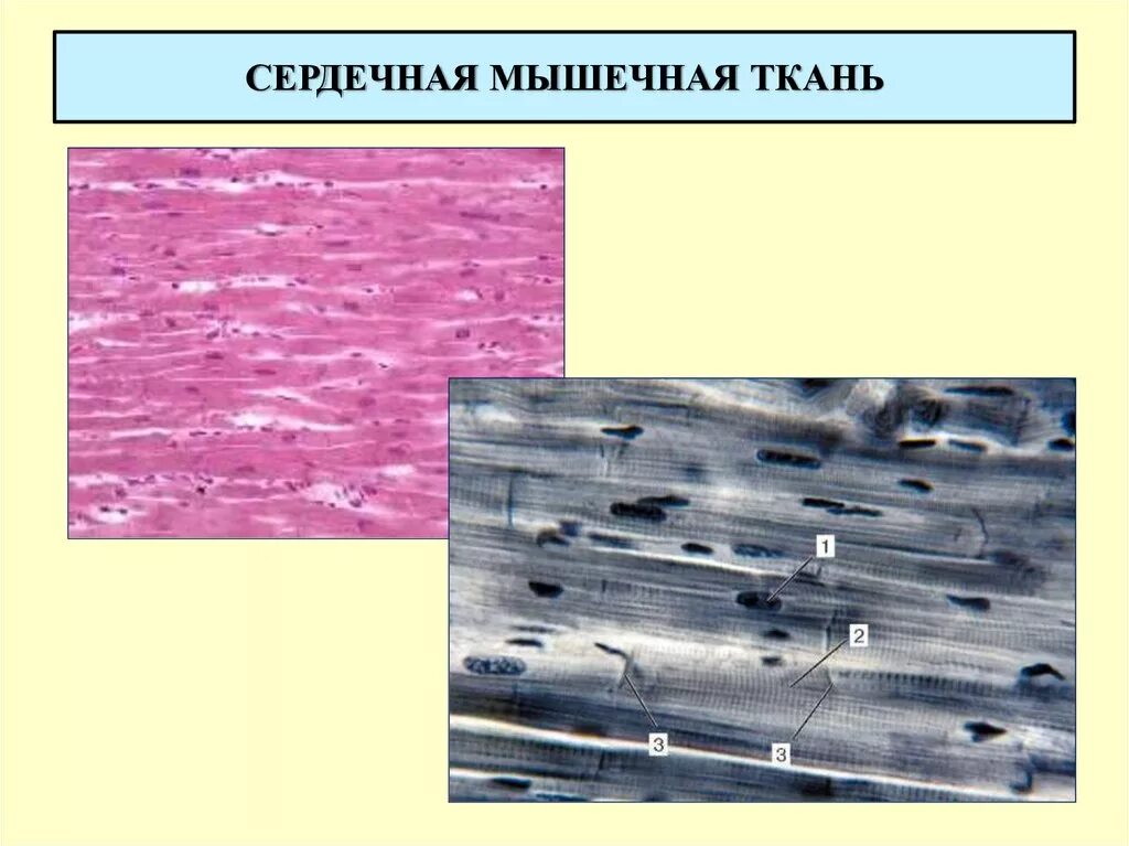 Поперечнополосатая сердечная мышечная ткань строение