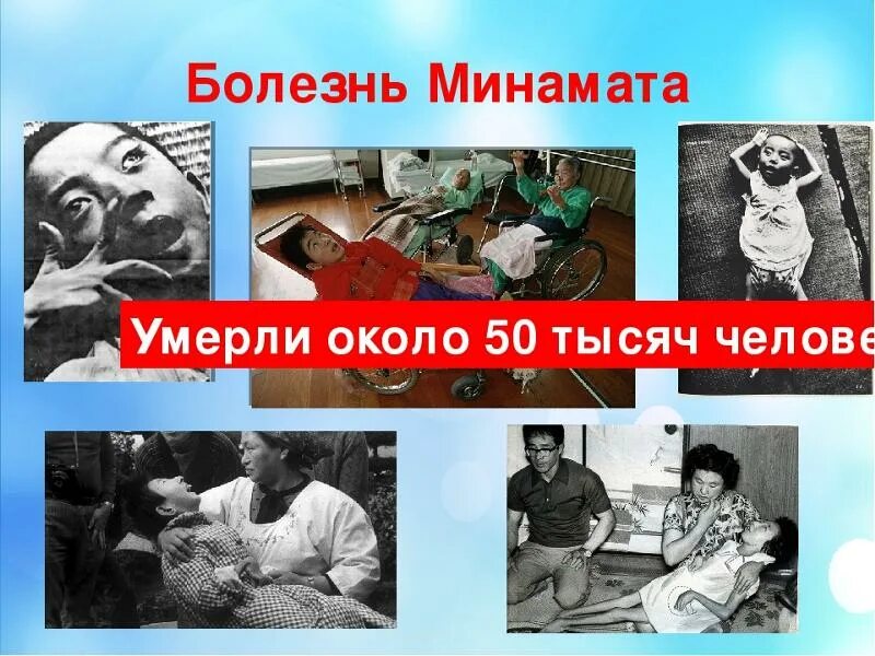 Минамата экологическая катастрофа япония. Минамата ртутная катастрофа. Япония болезнь минаматы. Минамата отравление. Минамата болезнь ртуть.
