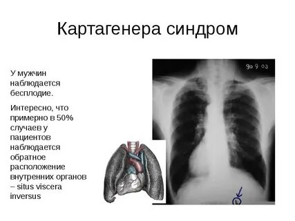 Зеркальные органы