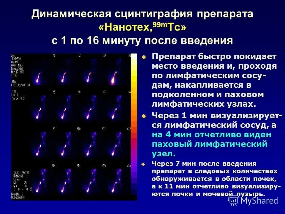 Сцинтиграфия прямая проекция. Статическая и динамическая сцинтиграфия почек. Записаться на сцинтиграфию. Гамма сцинтиграфия. Сцинтиграфия легких при тэла.
