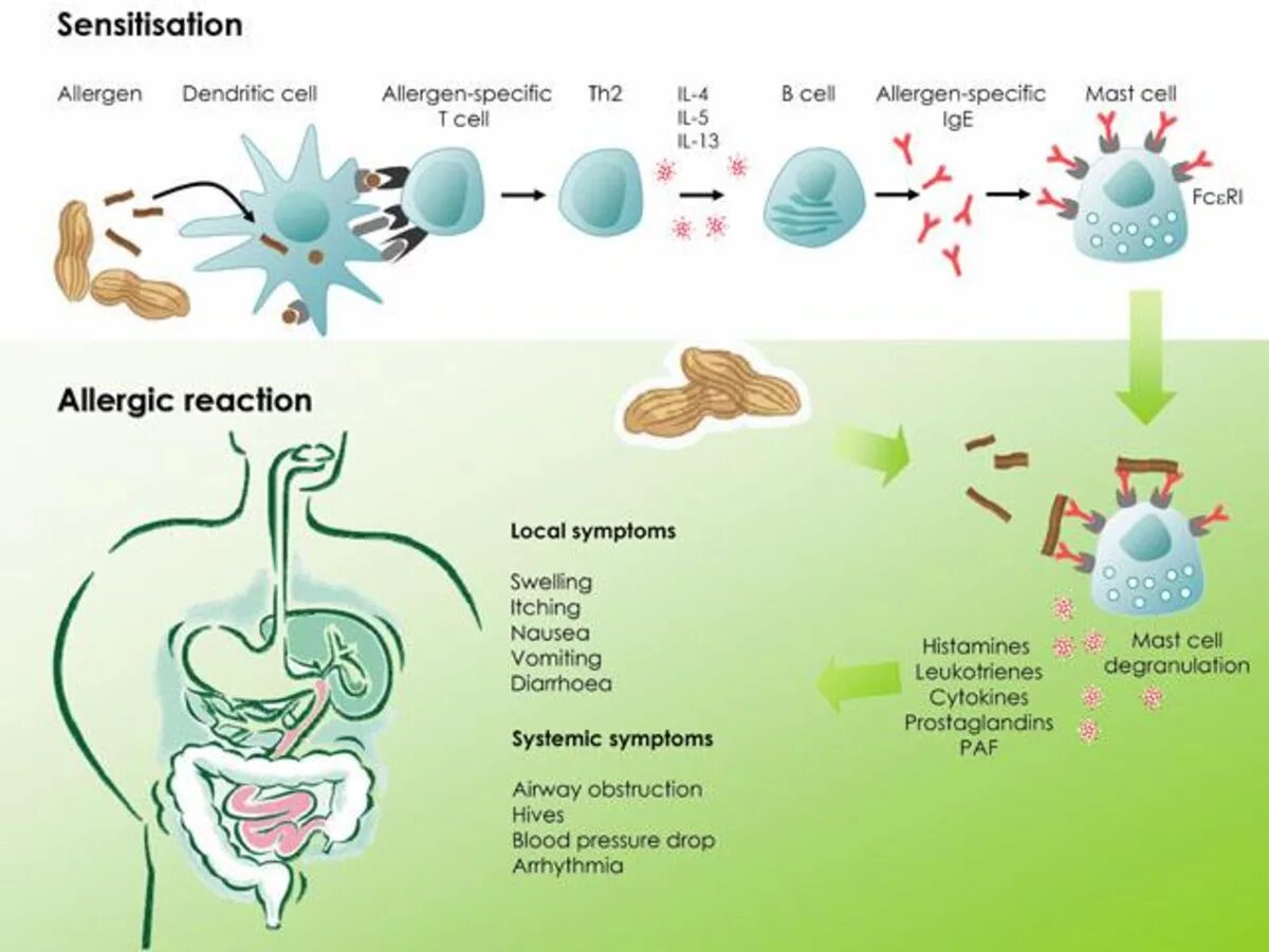 Без аллерген. Механизм аллергии. Пищевая аллергия схема. Аллергическая реакция на пищевые аллергены.