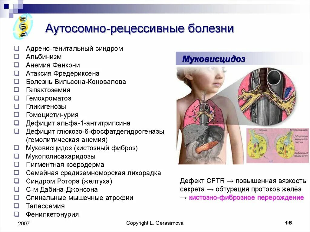 Аутосомные хромосомы заболевание. Аутосомно-рецессивные заболевания. Наследственные рецессивные заболевания. Аутосомнорецесивные заболевания. Аутосомно- рецессивноезаболевания.